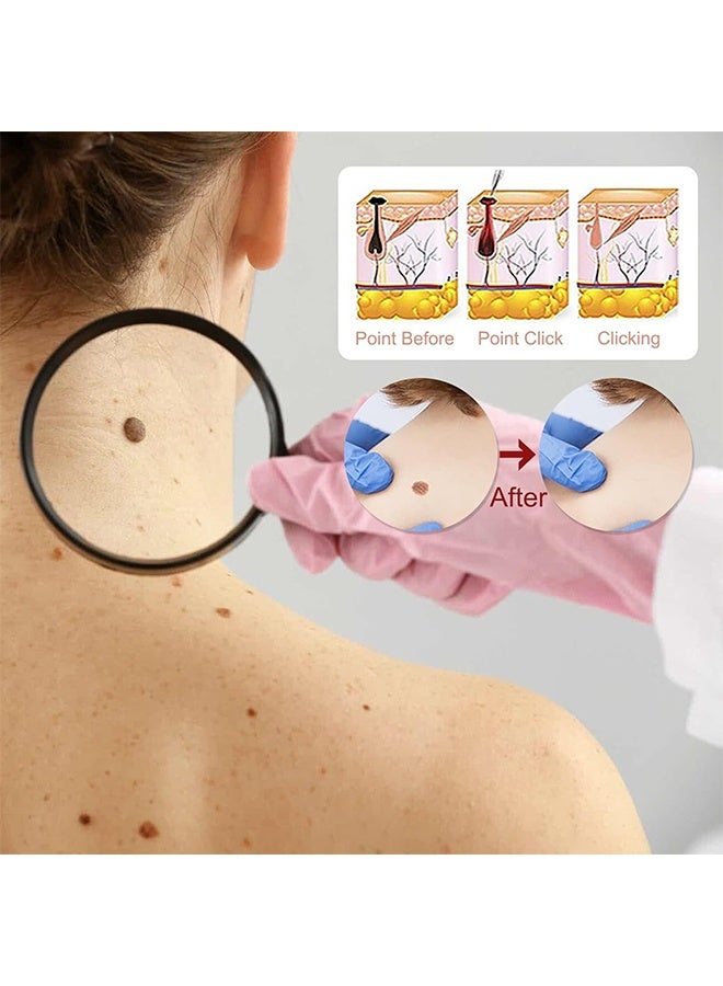 ximonth Microneedle Botanic Skin Tag Solution Patch, 9 Pcs Skin Tag Remover Patches,  Acne Blemish Remover, Balances Oil And Moisture, Safe & Gentle, Waterproof Adhesive, Natural Plant, Based Ingredients For Small To Medium Skin Tags On Face & Body - Image 5